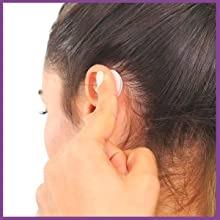 Cosmetic Protruding Ear Corrector for Ear Pinning without Surgery