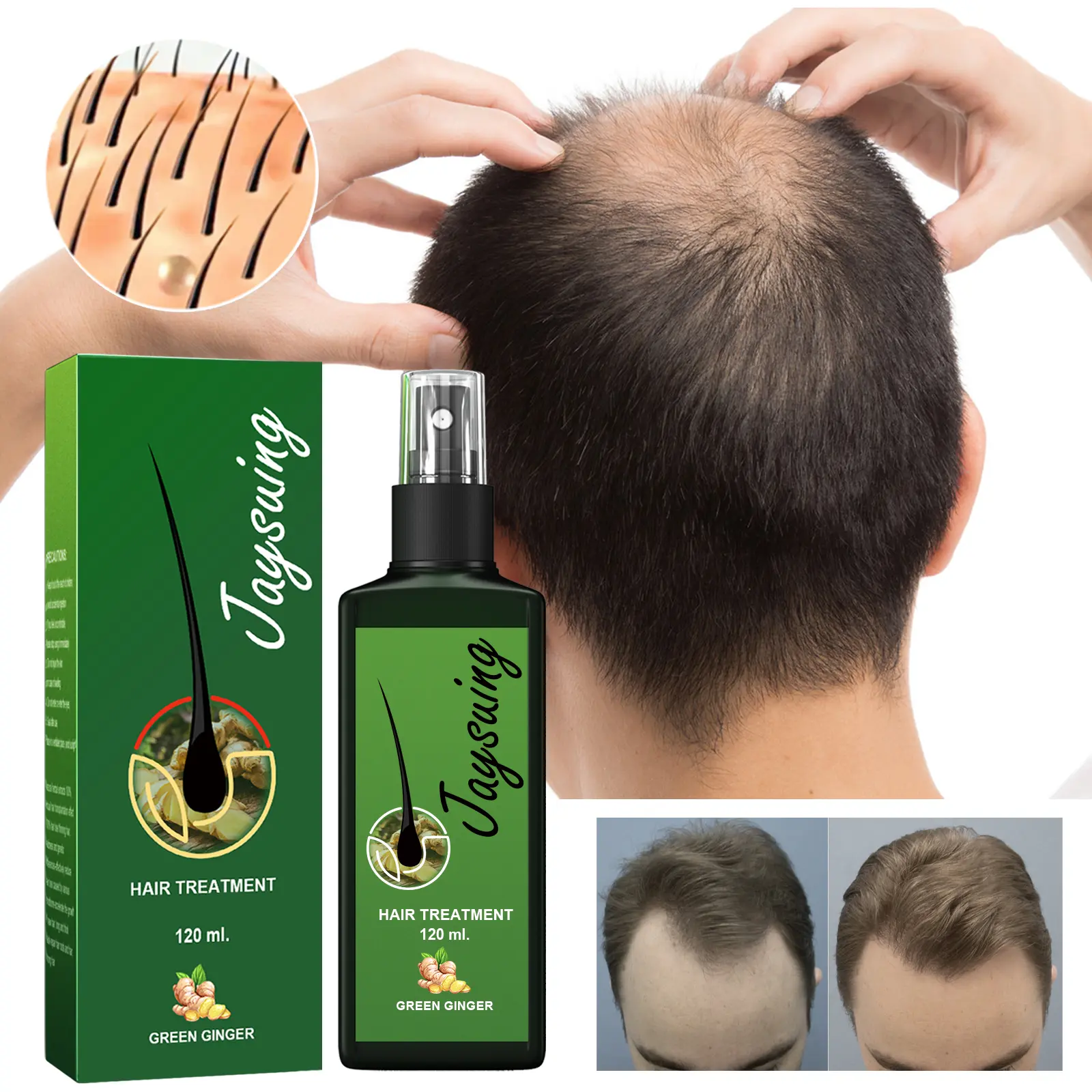 Jaysuing Hair Care Spray - Haircare Conditioner for Scalp Care Routine, Gentle Nourishing Massage, Moisturizing Softening, Repair & Growth Support Solution