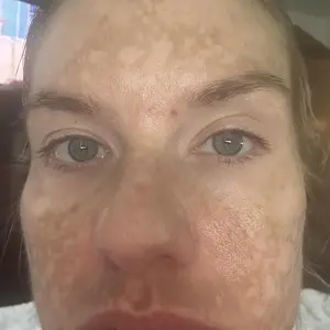 Product Review of [NEW] [medicube] No Cast Just Glow Collagen Sunscreen | SPF 50 Broad Spectrum Face Sunscreen | Lightweight, Non-Sticky, Hydrating Formula | No White Cast or Residue | Peptide, Cica for Soothing & Natural Glow from A**y S**s ** W** R**R **