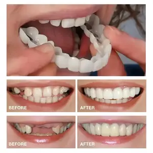 Instant Bright Smile Veneers, Upper & Lower Comfortable False Teeth Cover, Unisex Realistic Temporary Dentures Perfect for Photo & Party