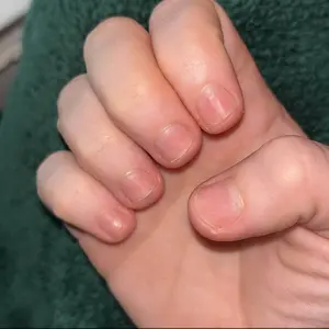 Product Review of Radiant Cosmetics Nail Growth Oil - 100% Organic, Moisturizing, Growth, Strengthening, and Brightening Formula with Vitamins and Fatty Acids for Overall Nail Health from E**