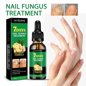 Jaysuing 7 Days Ginger Nail，Treatment Nail Support Nail Care，Nail Polish Nail Art Manicure Comfortmoisturizes and thickens nails - longer，stronger and brighter nails rough skin