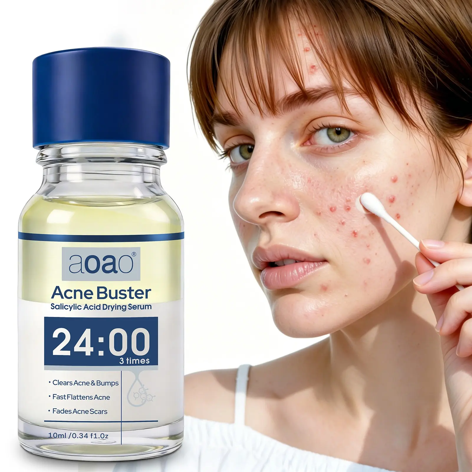 AOAO Acne Serum, Blemish Control, Body Treatment, Visibly Shrinks Pimples in 24 Hours & Helps Fade Acne Marks in 7 Days, With 1.8% Encapsulated Salicylic Acid, 5% Niacinamide & 20% Zinc Oxide, Sensitive Skin