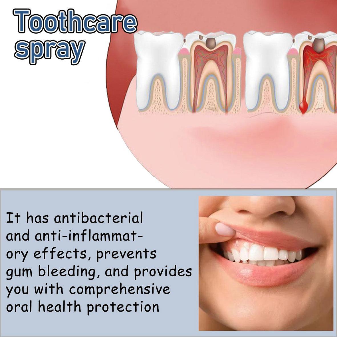 ORALHOE Oral Care Spray  - Preventing toothsensitivity, Relieving swollen and inflamedgums, Helping reduce tooth decay, Gentleformula for daily use