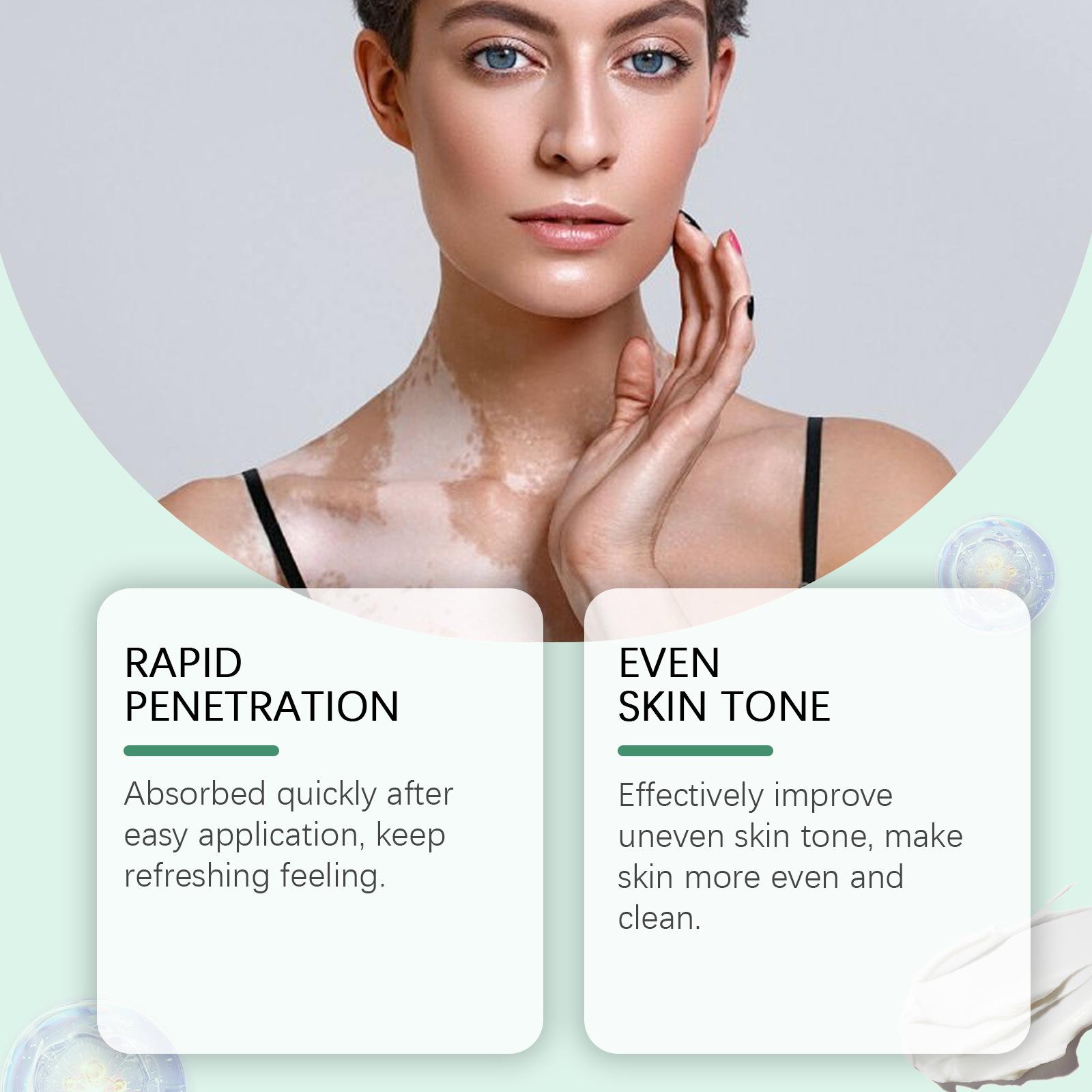 Psoriasis treatment cream, improves the original skin pigment deposition, with a clean formula without any harmful additives.