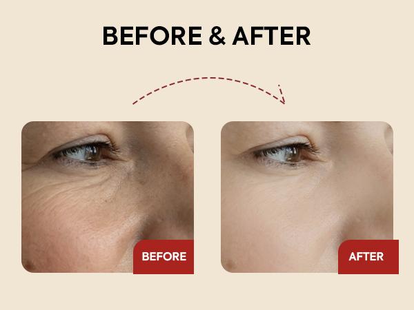 K-SECRET SEOUL 1988 Retinal Serum: 2% Retinal, Black Ginseng, Niacinamide, Bakuchiol, Vitamin C & Peptides for Wrinkle Care, Korean Skincare - 30mL K-SECRET SEOUL 1988 Retinal Serum: 2% Retinal, Black Ginseng, Niacinamide, Bakuchiol, Vitamin C & Peptides for Wrinkle Care, Korean Skincare - 30mL