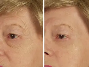 DIVADEVA Reverse Instant Wrinkle Remover Skincare Smooth