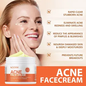 Teen Pimple Acne removal Cream 100g Spot Remover Skin Care Solution Teen Pimple Acne removal Cream 100g Spot Remover Skin Care Solution