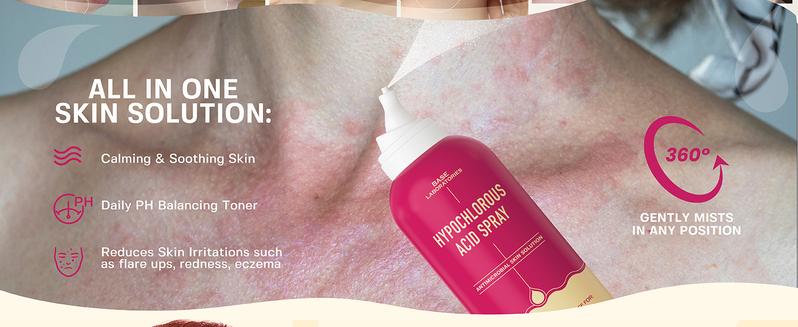 Base Laboratories Hypochlorous Acid Spray & Wipes Bundle - 75 Wipes & 8oz Spray for Acne Eczema Piercings & Irritations Fast Relief for Daily Use Base Laboratories Hypochlorous Acid Spray & Wipes Bundle - 75 Wipes & 8oz Spray for Acne Eczema Piercings & Irritations Fast Relief for Daily Use