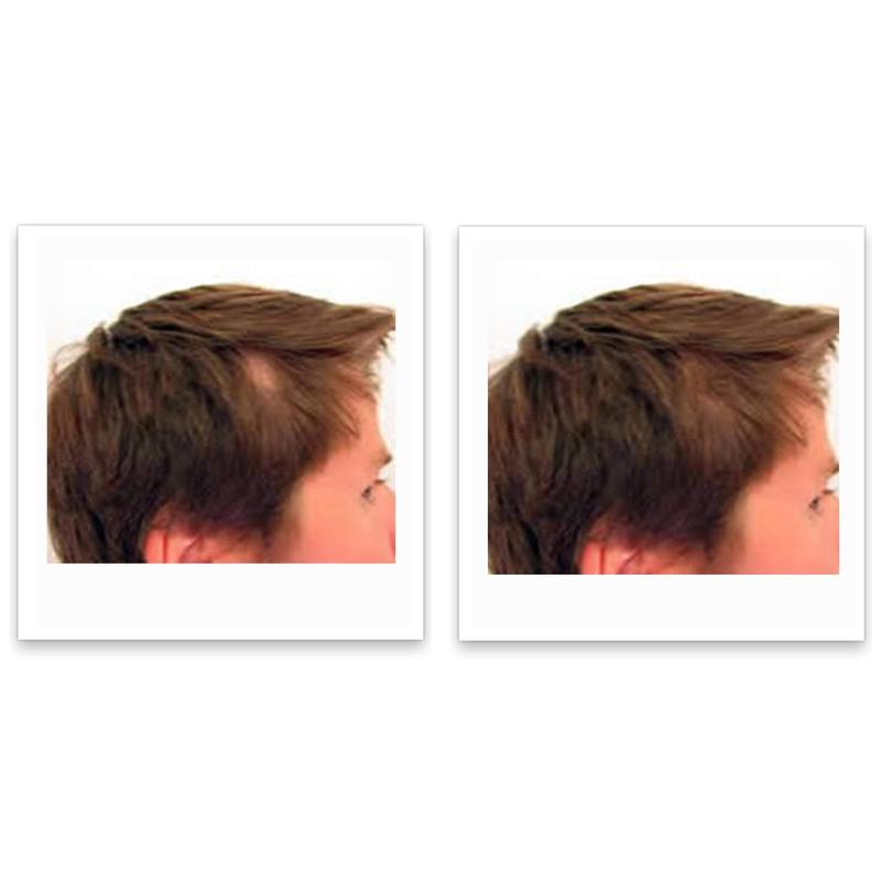 Caboki 10X Hair Powder - LIMIT ONE PER HOUSEHOLD. Full Coverage for Hairline & Thin Areas, Talc-Free Formula, Natural Ingredients, Waterproof, TRIAL SIZE