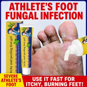 Specialized foot repair cream for fast relief from itching and odor caused by athlete’s foot. Targets peeling soles, blisters on toes, excessive foot sweat; penetrates, inhibits bacteria, soothes redness and dryness/itching. Say goodbye to embarrassing at