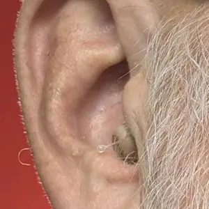 Audien Atom Air OTC Hearing Aids – Lightweight & Invisible, 24Hr Battery, FDA Registered, No App Needed, $149/Pair