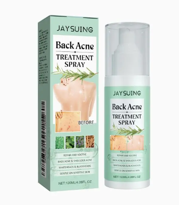 Back & Shoulder Acne Spray - Repair & Soothe Acne-Prone Skin (120ml)