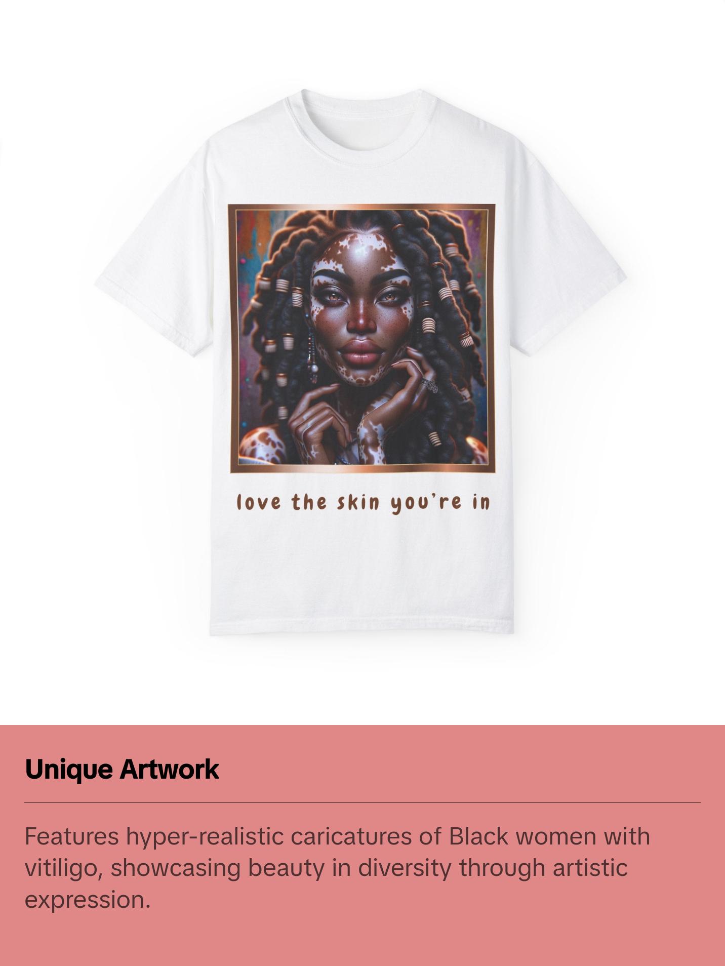 Exquisite Expressions: Celebrating the Unique Beauty of Vitiligo T-Shirt, Love the skin you're in Womenswear Casual Fashion Comfort Streetwear