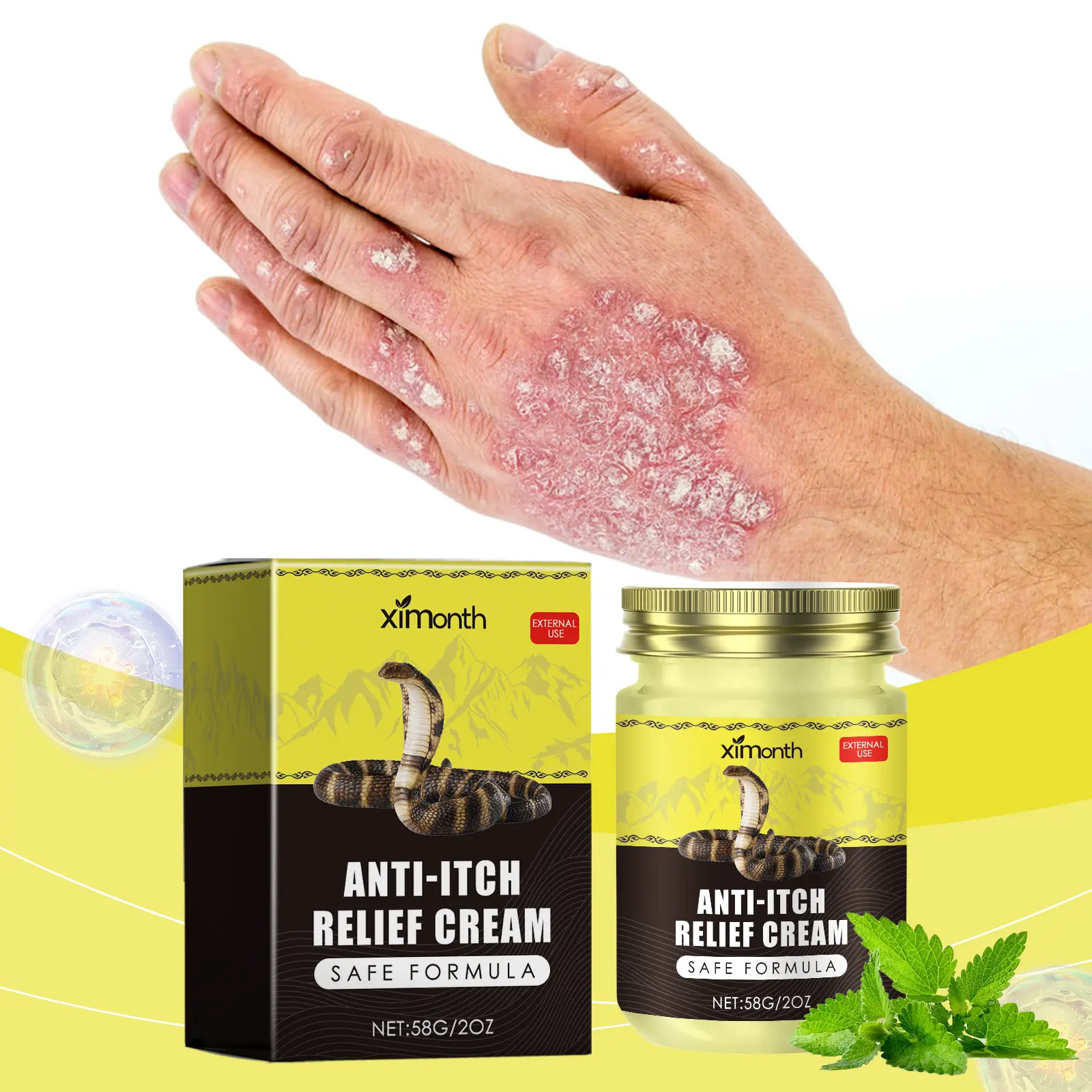 Ximonth Psoriasis Skin Care Cream (58g) - Psoriasis Therapy & Treatment, Relieves Itching and Redness, Moisturizes and Nourishes the Body, Gently Applicable
