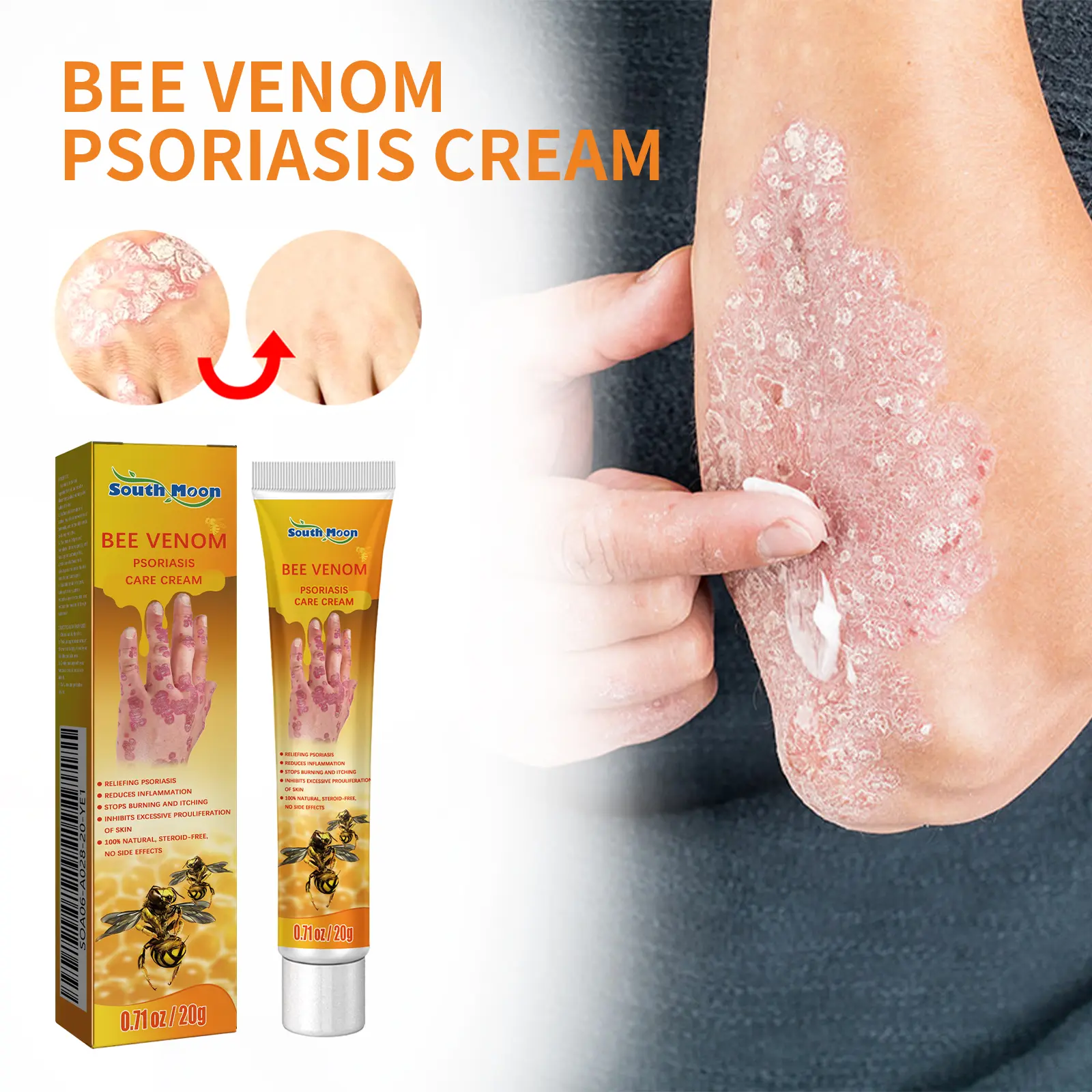 South Moon Psoriasis Skin Care Ointment, an external body cream that relieves itchy and swollen skin while moisturizing and nourishing the skin