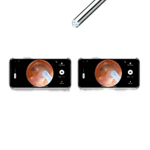 Smart Visual Ear Cleaner 3.9mm Visible Endoscope Ear Picking Tool Wireless Otoscope Electric Ear Scoop Earwax Removal Tool