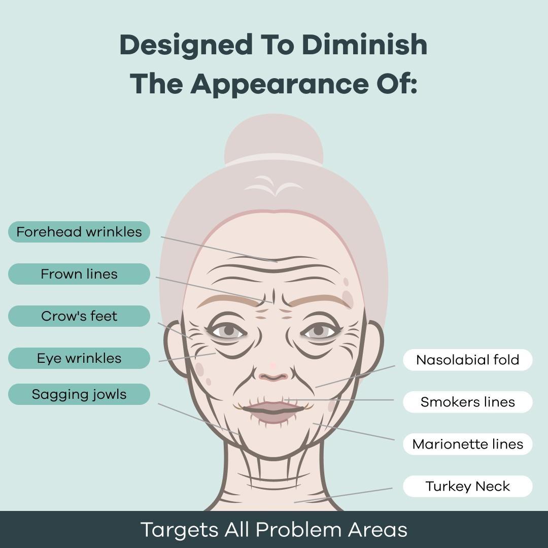 Seranova Microneedling Infusion Kit Anti-Aging Skincare Solution Micro-Infusion Wrinkles & Dark Spots Serum Bundle