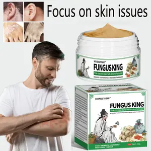 Fungal King Hand and Foot Care Cream for Itchy, Peeling, and Itchy Feet - Herbal Formula Extracts Suitable for Itchy Skin All Over the Body