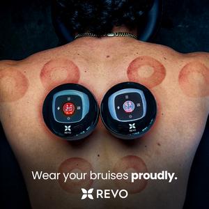 REVO The Original Smart Cupper Device, Red Light + Heat + Suction Therapy | Muscle Relief, Cellulite & Recovery | Choose from 1x / 2x / 4x + Free Kits