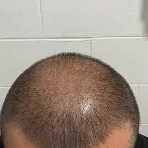 Men's Professional Gold Beard Trimmer: Cordless Rechargeable Clipper/Trimmer Set, Barber-Grade Precision for At-Home Grooming (Luxury Gold)