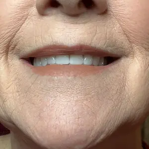 Product Review of Blurfiller Blurring Lip Contour, Buildable Formula, Line, Define, Contour, L'Oreal Paris from p**🥰