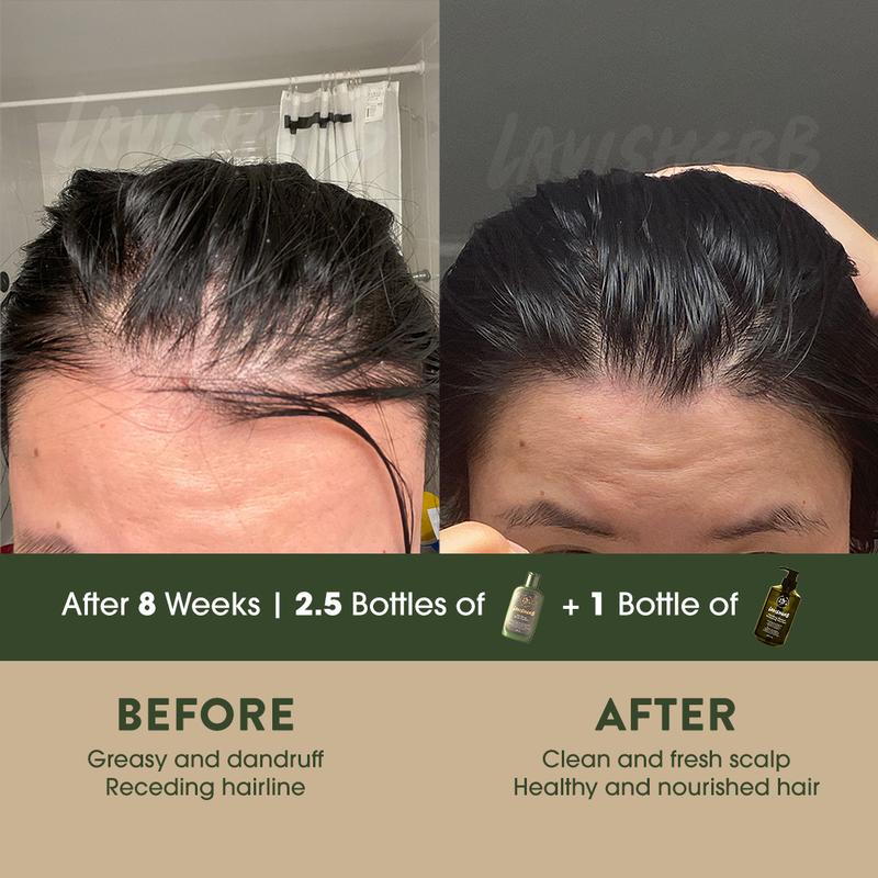 Lavisherb Hair serum | Revitalize Repair Hair Loss Excessive Scalp Sebum Greasy Hair All Natural Ingredients - 200ml