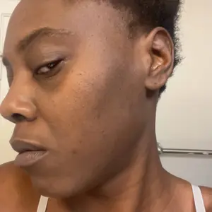 [medicube] Hypochlorous Acid Rice Peel Shot Duo For Face & Body | Gentle Exfoliating Serum for Dead Skin Cells & Pore Care, Blackheads & Excess Sebum Control | Rice Extract, Hypochlorous, Panthenol for Hydrating & Smoothing Care