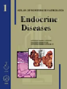 USED-Endocrine Diseases (AFIP Atlas of Nontumer Pathology) by Lloyd, Ricardo V., M.D. (Hardcover)