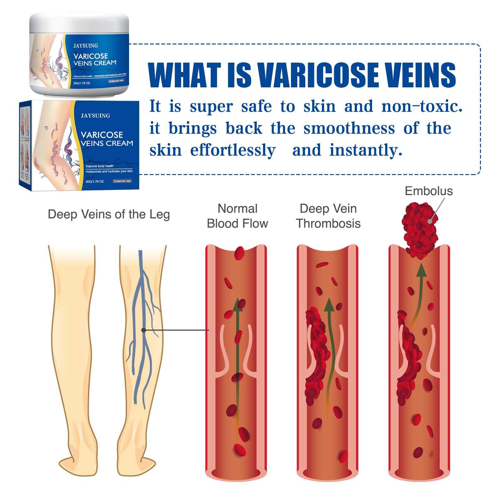 50g Varicose Veins Repair Lotion, Mild Hydrating Leg Massage Cream for Vein Care, External Body Soothing Cream to Relieve Leg Fatigue, Swelling and Discomfort, Daily Leg Skin Care Treatment
