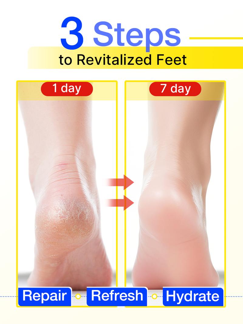 Aavini Intense Foot Cream - Repairs Cracked Skin, Antibacterial and Deodorizing, Removes and Softens Calluses, For All Skin Types, Moisturizing Foot Lotion Aavini Intense Foot Cream - Repairs Cracked Skin, Antibacterial and Deodorizing, Removes and Softens Calluses, For All Skin Types, Moisturizing Foot Lotion