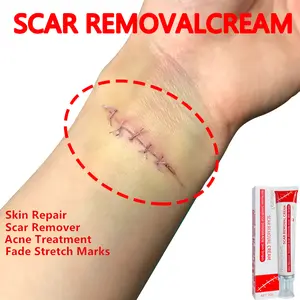 Professional Scar Removal Gel - Suitable for scar removal treatment of keloids, surgeries, C-sections, burns, acne, etc.