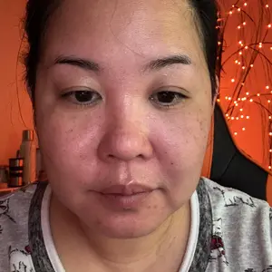 Product Review of [medicube] 310M Celebrity Glass Skin DuoㅣBooster Pro Korea's No.1 Glass Glow Device + Collagen Jelly Cream OR Deep Vita C Cream from 🩵**🩵