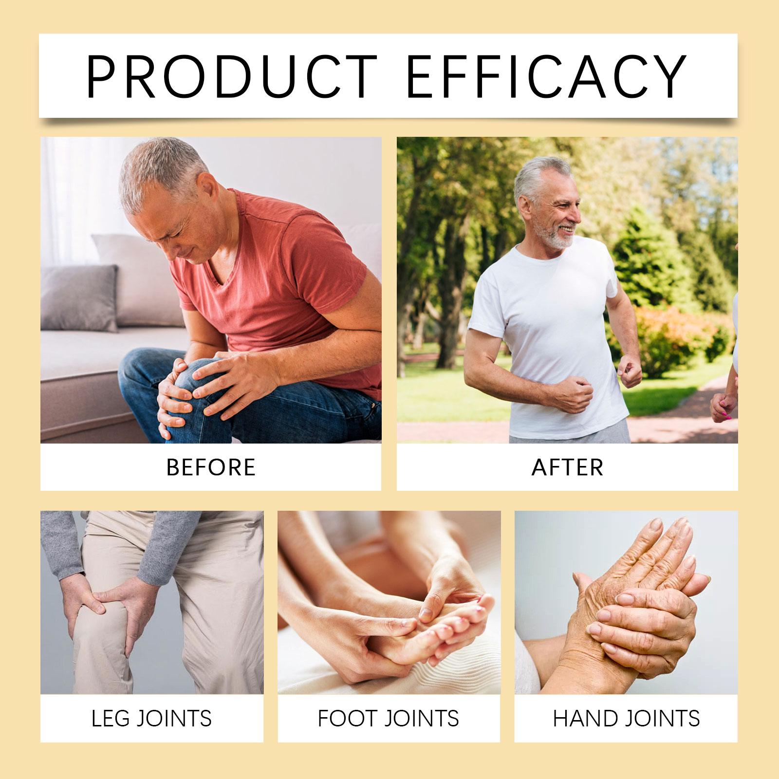 Ximonth Bee Venom Soothing Massage Cream, Moisturizes And Soothes Joint Discomfort With Daily Massage For Topical Treatment