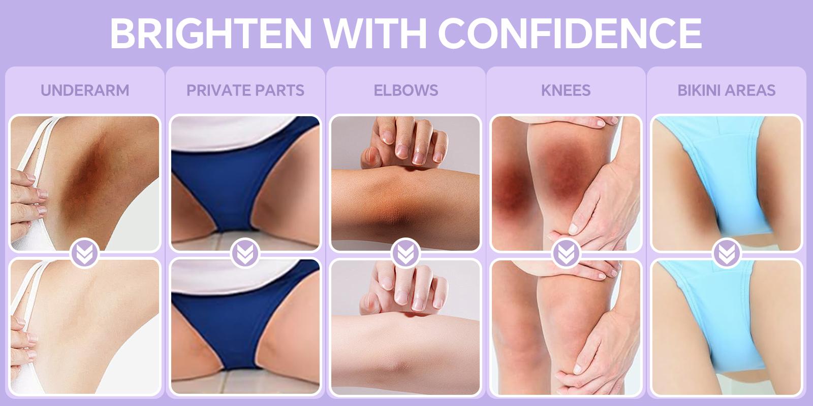 Bikini & Underarm Dark Spot Care Serum for Sensitive Skin – Brightening Formula with Niacinamide & Vitamin C, Helps Even Skin Tone & Smooth Skin for Intimate Areas (Women & Men)