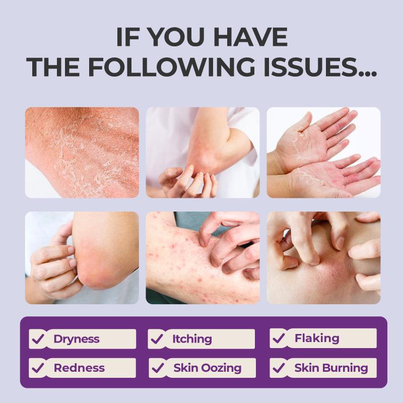 Kreain Nature 1 Skin Soothing Gel, Containing Indian Safflower Root Extract and Tea Tree (Mentha) Leaf Extract