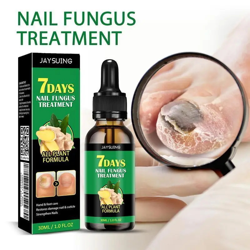 7days Nail Fungus Treatment, Ginger Nail Treatment, Multi-Purpose Nail Repair, Nail Nutrient Oil Strengthener Oil SerumGinger Nail Growth Oil Comfort
