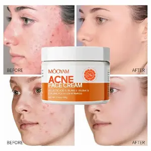 [FDA Certified] MOOYAM Acne Scar Cream (50ml) — Centella & Snail Repair Cream. Specially formulated to fade acne marks, treat acne, and eliminate blemishes. Fragrance-free and enriched with Salicylic Acid to deeply repair the skin.