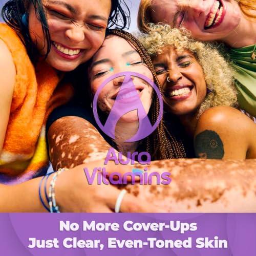 Vitiligo Cream for White Spots (4oz) - Repigmenting Cream with Polypodium Leucotomos and Melanocyte Support - Evens Skin Tone and Reduces Discoloration by Aura Dermacare