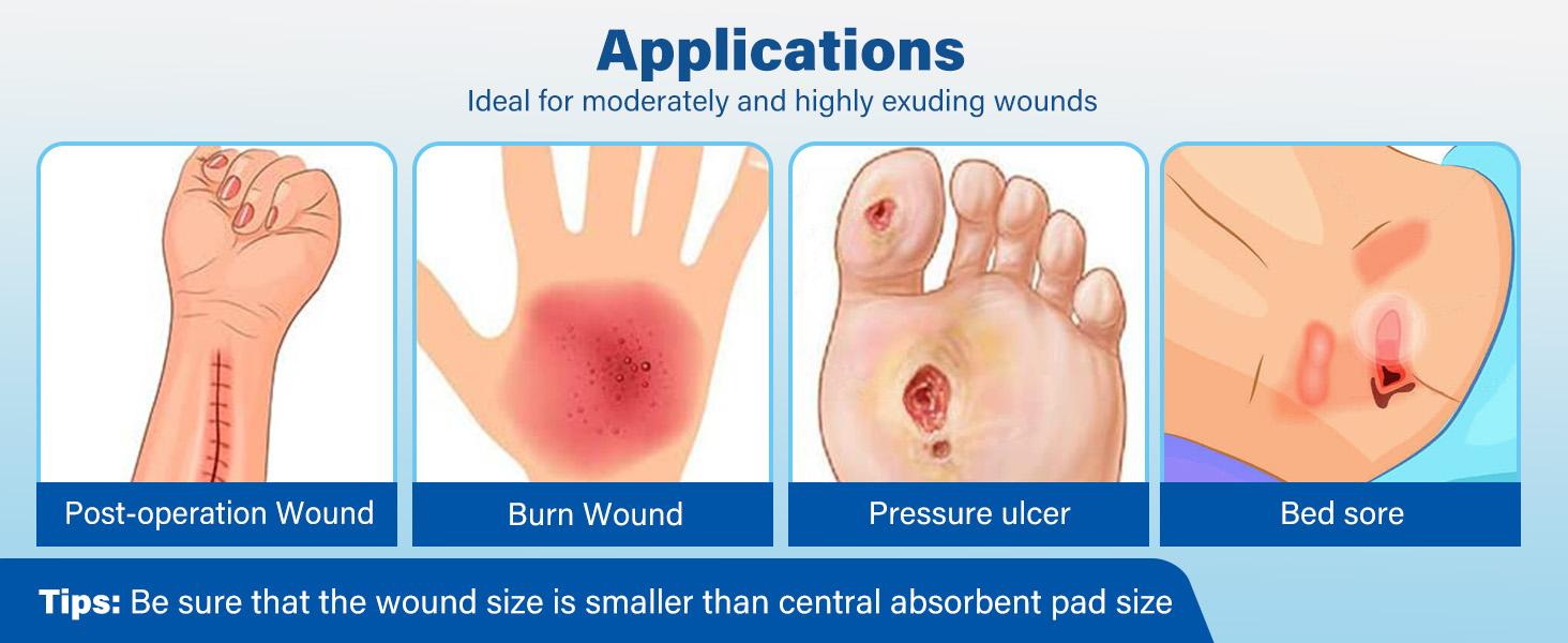 Silicone Foam Dressing with Border, 4"x 4" (2.5”x2.5” Pad), 5 Count, Sterile Adhesive Wound Dressing for Bed Sores, Leg Ulcers, Highly Absorbent, Waterproof Wound Care Bandage Silicone Foam Dressing with Border, 4"x 4" (2.5”x2.5” Pad), 5 Count, Sterile Adhesive Wound Dressing for Bed Sores, Leg Ulcers, Highly Absorbent, Waterproof Wound Care Bandage