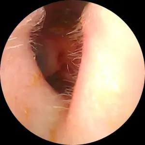 Silicone Ear Hygiene Set, HD Visual Earwax Removal Tool with Camera, 1296P HD Camera Ear Cleaner, Compatible with iPhone and Android Phones, Springtok, Spring Gift Set