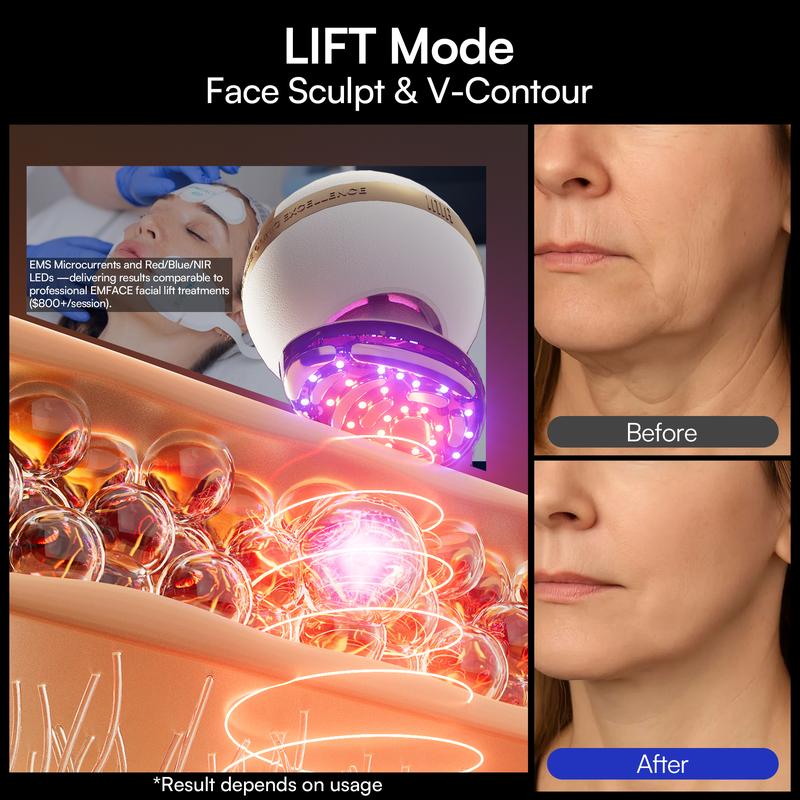 【LIVE EXCLUSIVE】INIA SPHERA At-Home RF & LED Anti-Aging Facial Device – Lift, Tighten & Sculpt with EMS Microcurrent, Red Light Therapy, Electroporation & Cryo Cooling for Firm, Glowing Skin. Perfect Black Friday Gift.