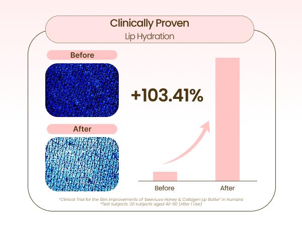 beenuvo Honey & Collagen Lip Butter - Honey Lip Balm for Deep Moisture & Skincare | 13g | Daily Lip Moisturizer