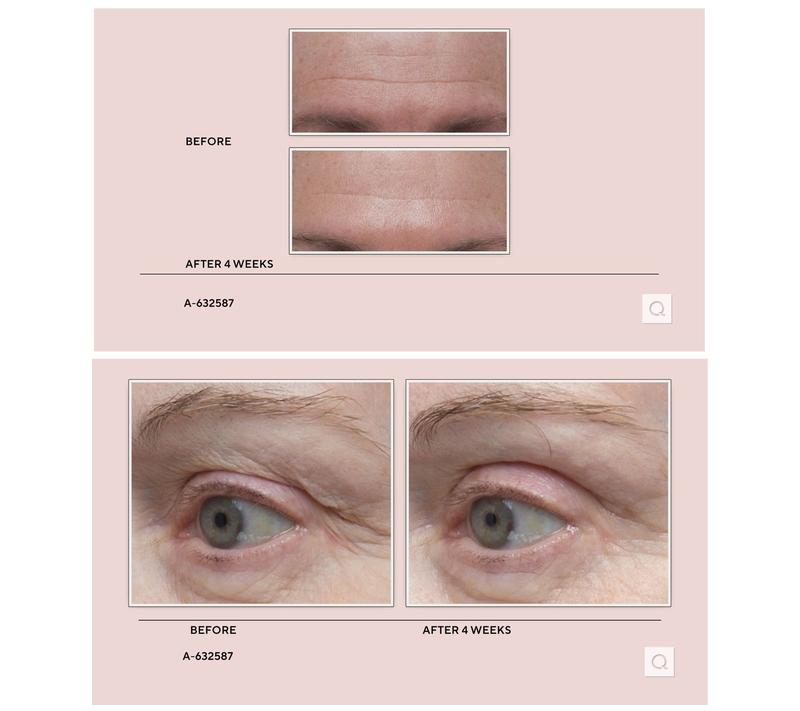 ELEMIS Pro-Collagen Marine Cream with Discovery Set