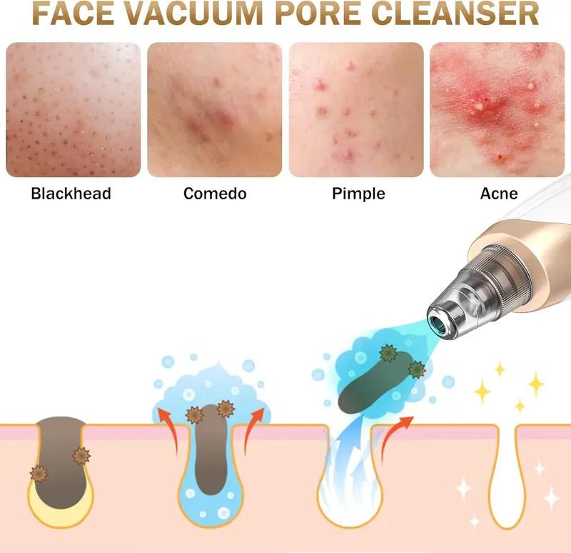 Electric Blackhead Cleaner, 1 Box USBRechargeable Facial Pore Cleaner with5 Cleansing Tips & 4 Counts Acne Acne