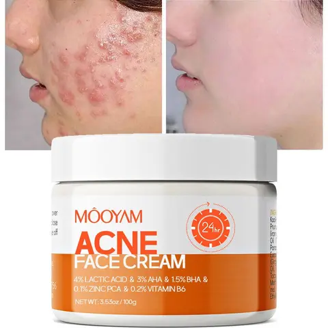 MOOYAM Acne Scar Treatment Cream 50ml Centella & Snail Repair Cream Post-Acne Marks Removal Acne&Pimple Treatment Fragrance Free Paraben Free Skincare Salicylic Skin Repair Sensitive Teens free skincare