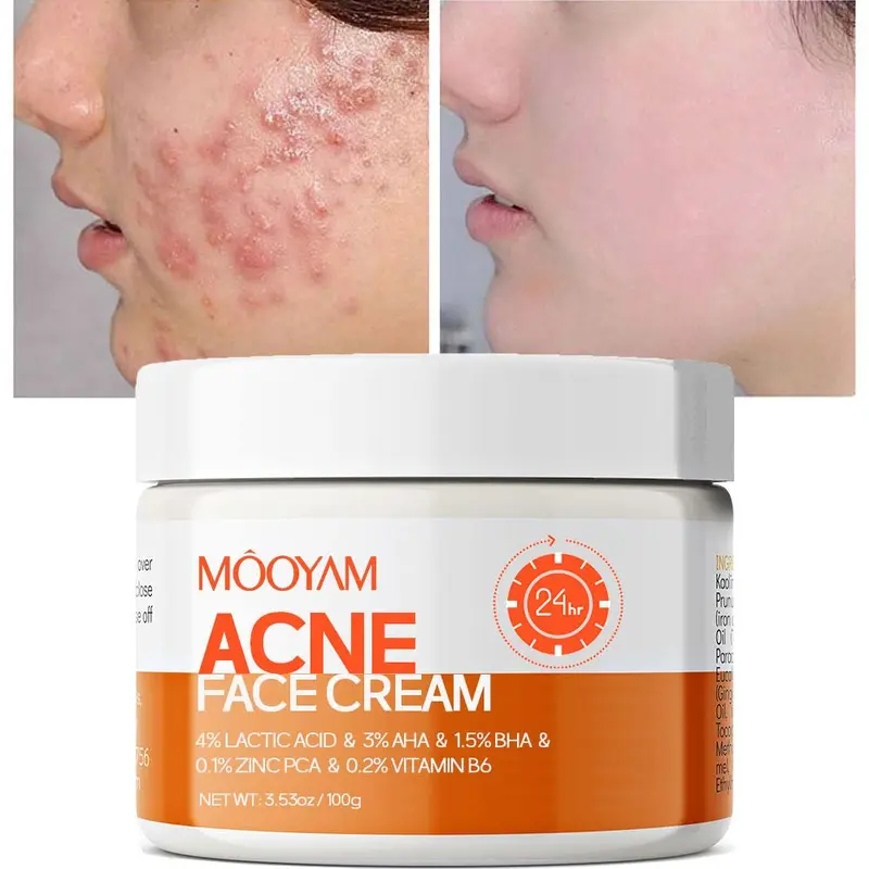 MOOYAM Acne Scar Treatment Cream 50ml Centella & Snail Repair Cream Post-Acne Marks Removal Acne&Pimple Treatment Fragrance Free Paraben Free Skincare Salicylic Skin Repair Sensitive Teens free skincare