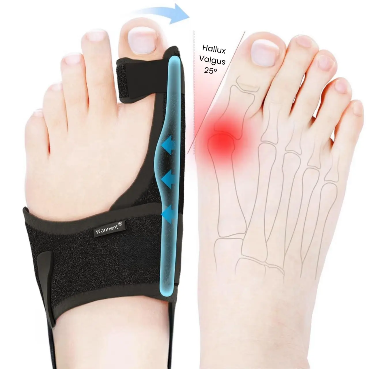2pc Bunion Corrector for Women Big Toe Straightener,Orthopedic Bunion Splint, Non-Surgical Hallux Valgus Correction, Hammer Toe Straightener, Comfortable & Breathable for Day/Night black one size