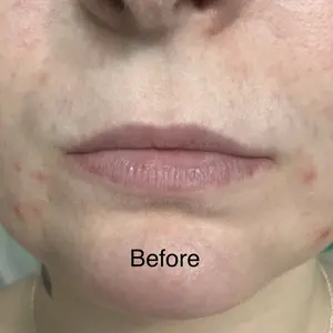 Product Review of [Laka] Soothing Prep Lip Mask — Cooling peel-off lip mask for smoother lip prep and a hydrated feel from S**a ** B**y ** F**y **