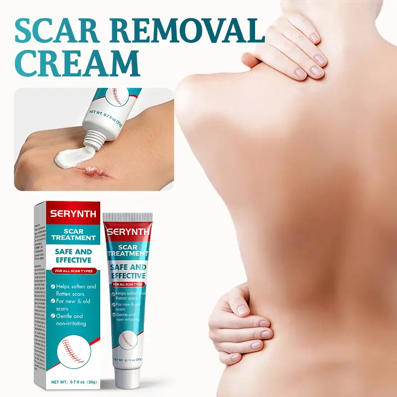 Scar and Acne Removal Cream | Acne Care Repair Cream | Acne facial serum safe for sensitive skin | Prevents scars from becoming keloids & fades scars